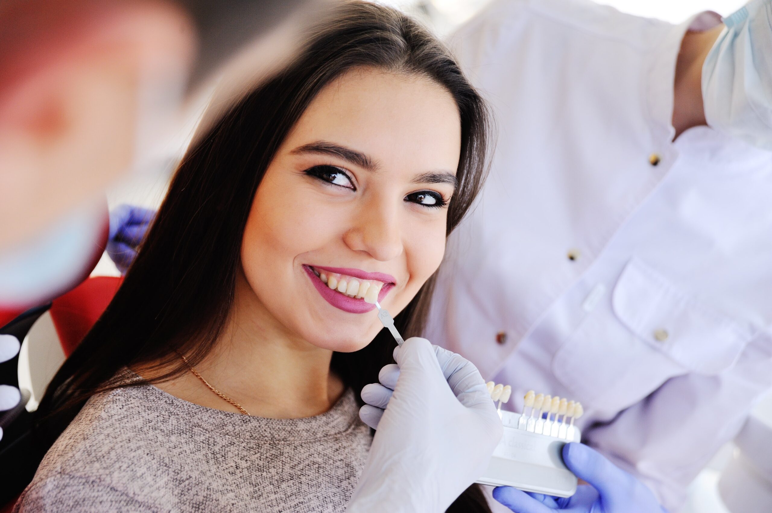 FACCETTE DENTALI