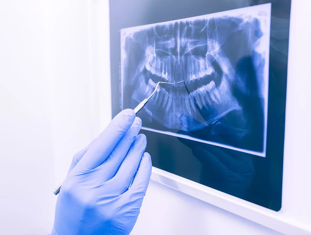 doctor-explaining-dental-xray