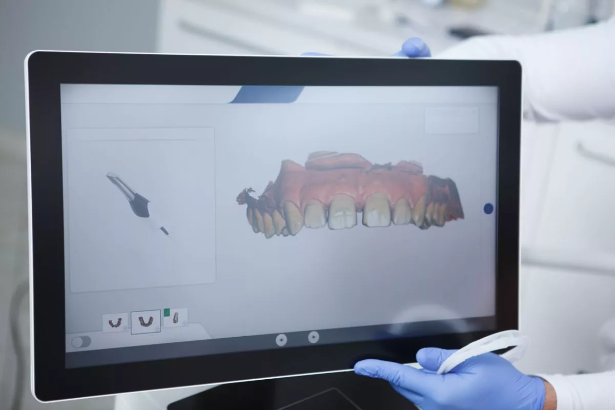 intraoral-jaw-scan-screen-dentists-office